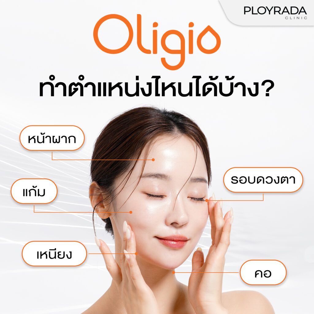 Oligio ทำตำแหน่งไหนได้บ้าง