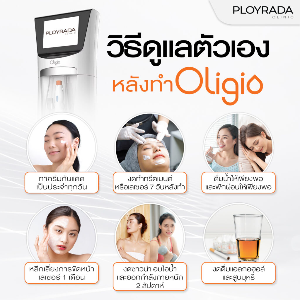 วิธีดูแลตัวเองหลังทำ Oligio