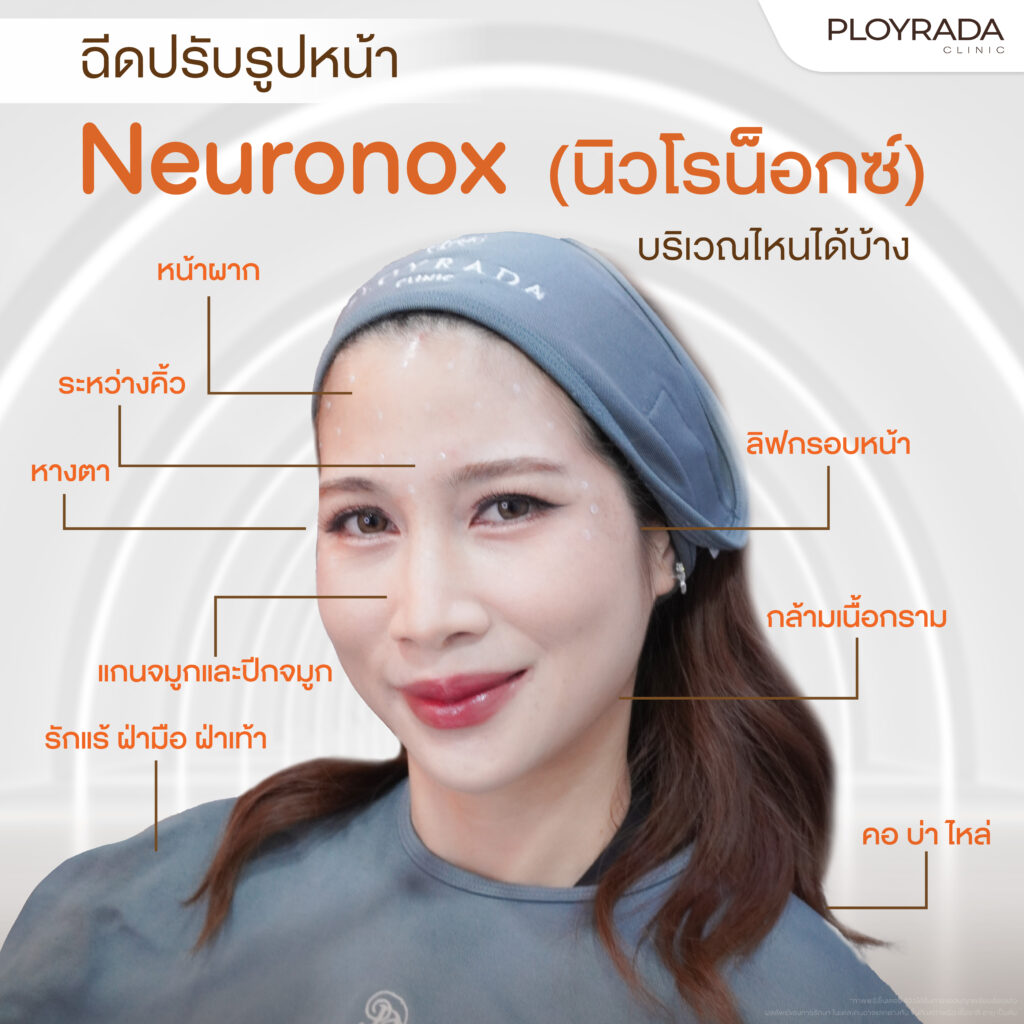 ฉีดปรับรูปหน้า Neuronox (นิวโรน็อกซ์) บริเวณตำแหน่งไหนได้บ้าง