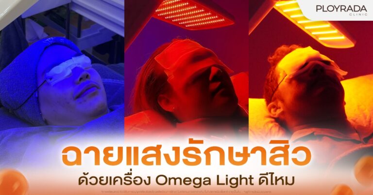 ฉายแสงรักษาสิว