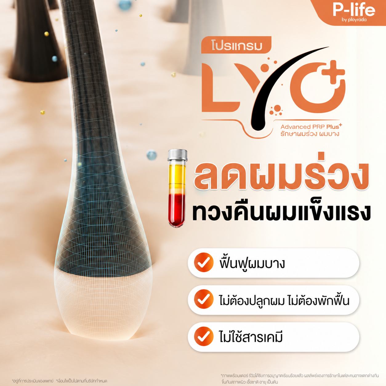 โปรแกรม LYO Advanced PRP Hair ฟื้นฟูรากผม ลดผมร่วง กระตุ้นเส้นผมใหม่ ที่ Ployrada Clinic