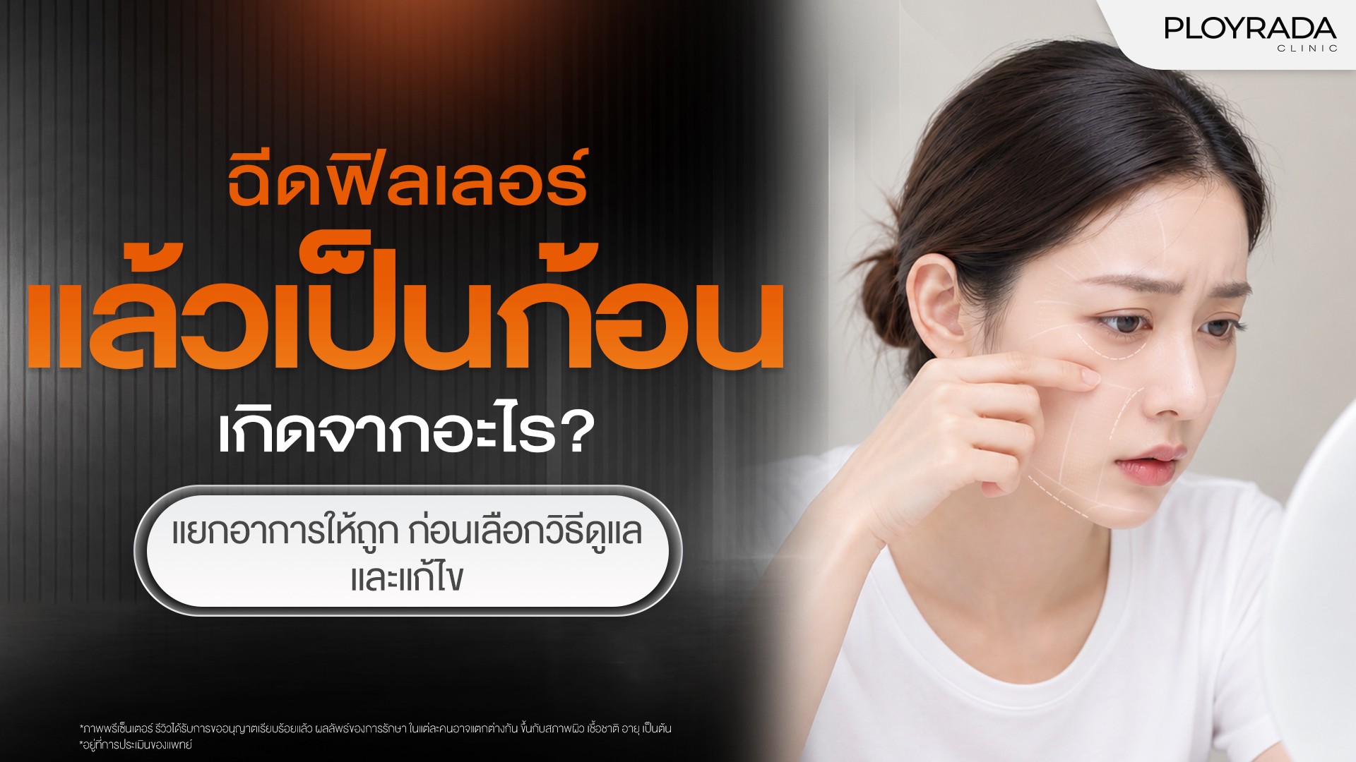 ฉีดฟิลเลอร์แล้วเป็นก้อน เกิดจากอะไร? วิธีป้องกันและแก้ไข