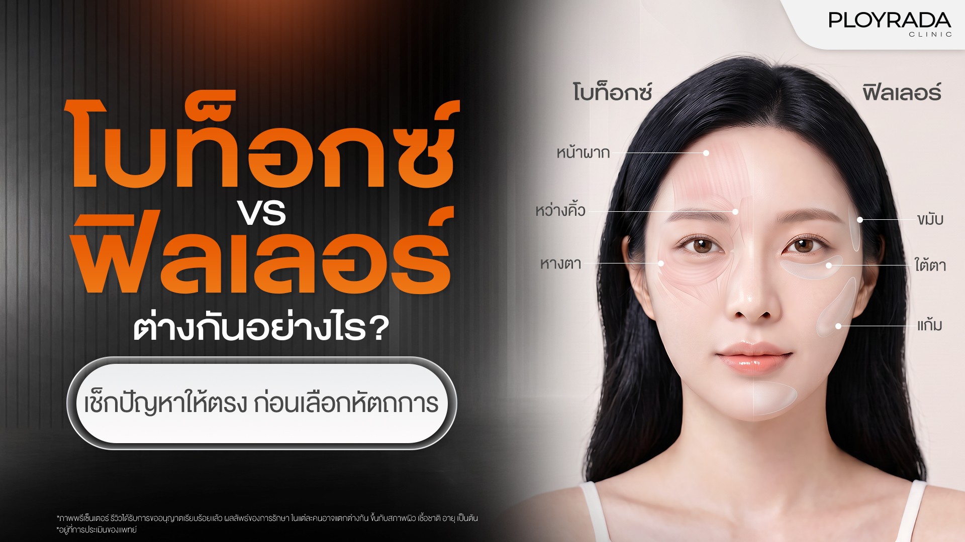 โบท็อกซ์กับฟิลเลอร์ต่างกันอย่างไร? ปัญหาแบบไหนควรเลือกวิธีไหน